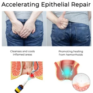 Miasaki Fast Herbal Hemorrhoid Spray