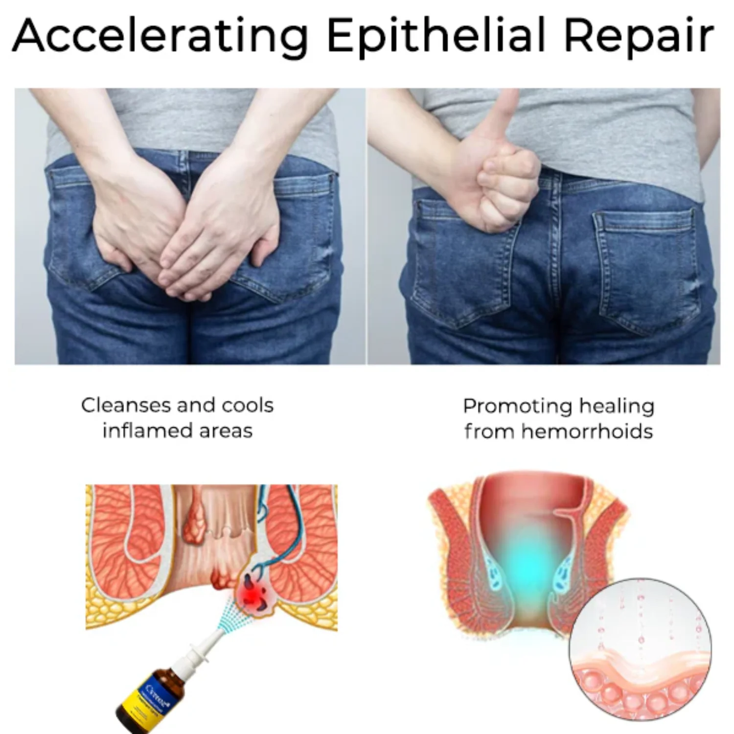 Miasaki Fast Herbal Hemorrhoid Spray