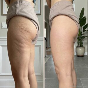 Birch & Bloom Anti-Cellulite Massage Oil Collagen + Stem Cell Infused