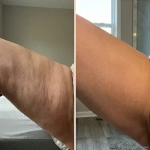 Birch & Bloom Anti-Cellulite Massage Oil Collagen + Stem Cell Infused