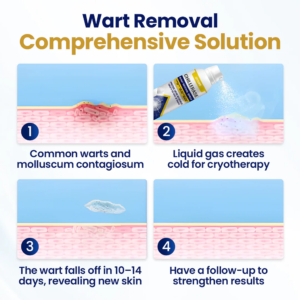 GFOUK® ChillErase Bump Renewal Spray