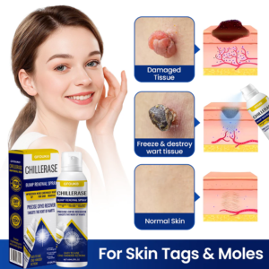 GFOUK® ChillErase Bump Renewal Spray