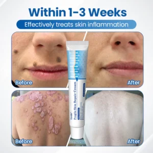 Timilk® Fragile Skin Repair Cream