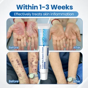 Timilk® Fragile Skin Repair Cream