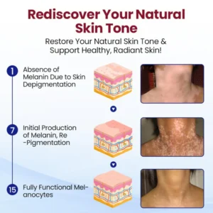 Healrize® Rapid Repair Vitiligo Essence