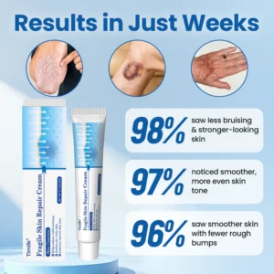 Timilk® Fragile Skin Repair Cream