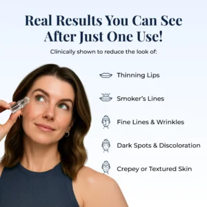 Glamory Microlift System