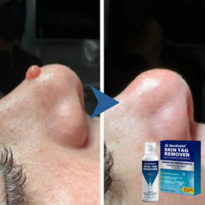 WartRelief Skin Tag Remover Premium Ingredients