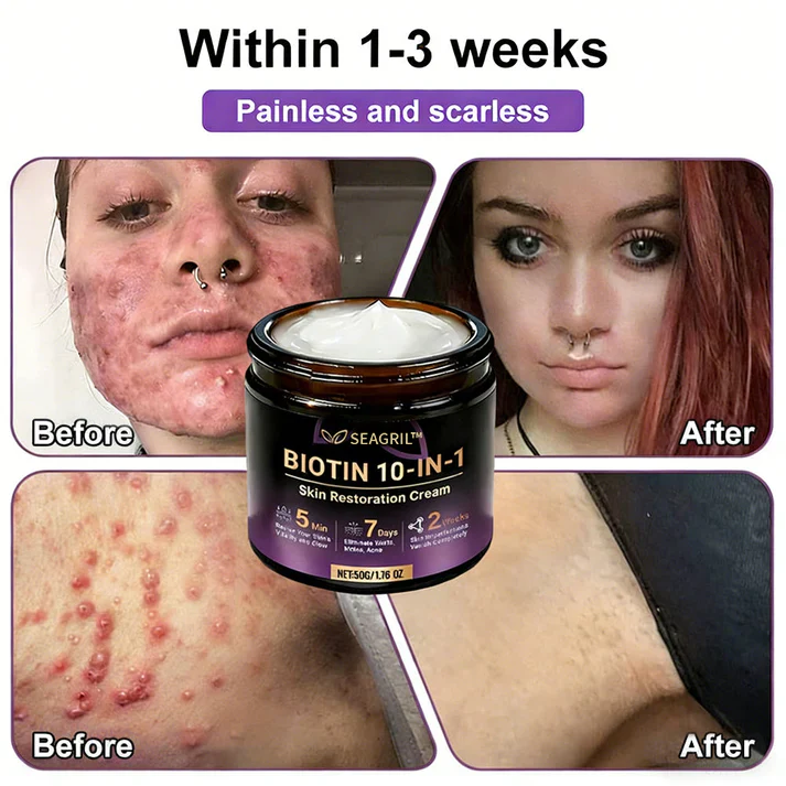 SEAGRIL® Biotin 10-in-1 Skin Restoration Cream