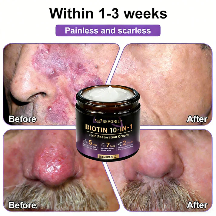 SEAGRIL® Biotin 10-in-1 Skin Restoration Cream