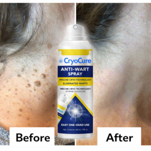 CryoCure Anti-Wart Spray Precise Cryo Technology