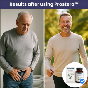 Prostera Food Supplement with Plant Extracts and Zinc