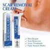 LOVILDS Scar Repair Cream