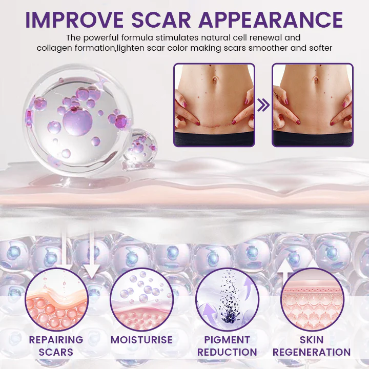Acezozla® ReGenScar Stem Cell Scar Gel