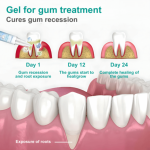 Qelunique Gum Protect Repair Gels