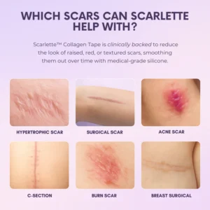 Scarlette™ Silicone Collagen Sheets