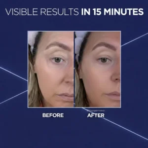 Eye Skincare Under-Eye Bag Cream Barubt