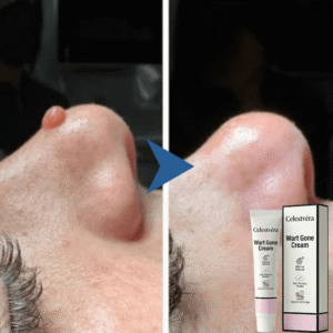 Celestvéra Wart Gone Cream Effective Removal