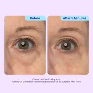 Quvello Instant Eye Lifting Gel