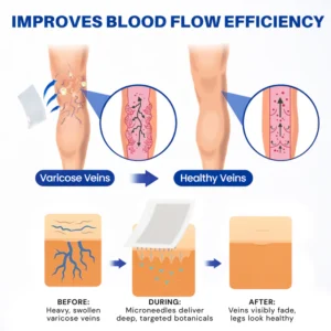 Alisanda® Vein Contour Microneedle Patch