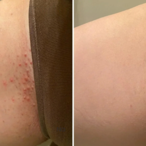 IntimaCare Women Private Itching Relief Cream