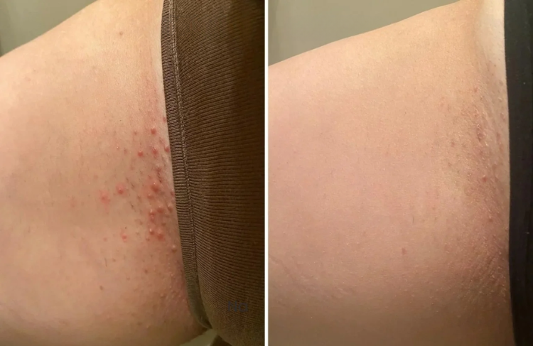 IntimaCare Women Private Itching Relief Cream