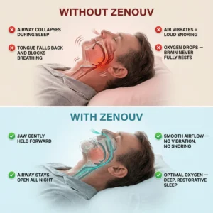Zenouv Anti-Snoring Mouthpiece