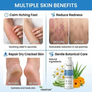 Healrize® Magnesium Botanical Spray