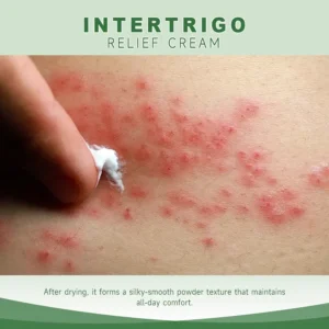 Nuvelliana Intertrigo Relief Cream