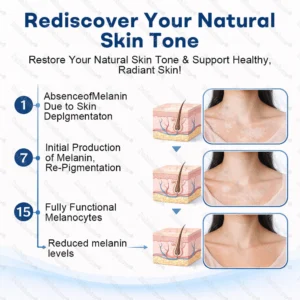 Healrize® Piperine Vitiligo Repigmentation Spray