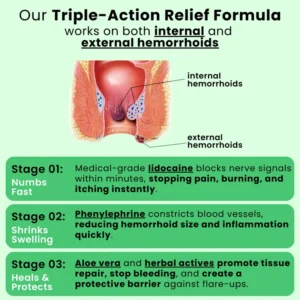 Nuvelliana Hemorrhoid Ointment