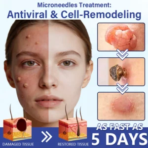 Timilk® DermalRepair 2-in-1 Microneedle & Hydrocolloid Patch