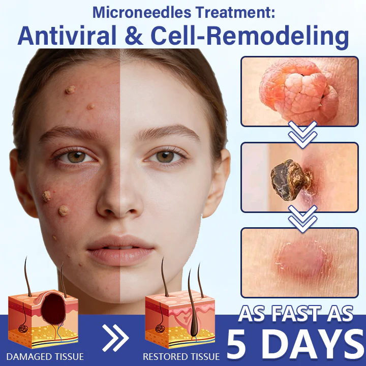 Timilk® DermalRepair 2-in-1 Microneedle & Hydrocolloid Patch