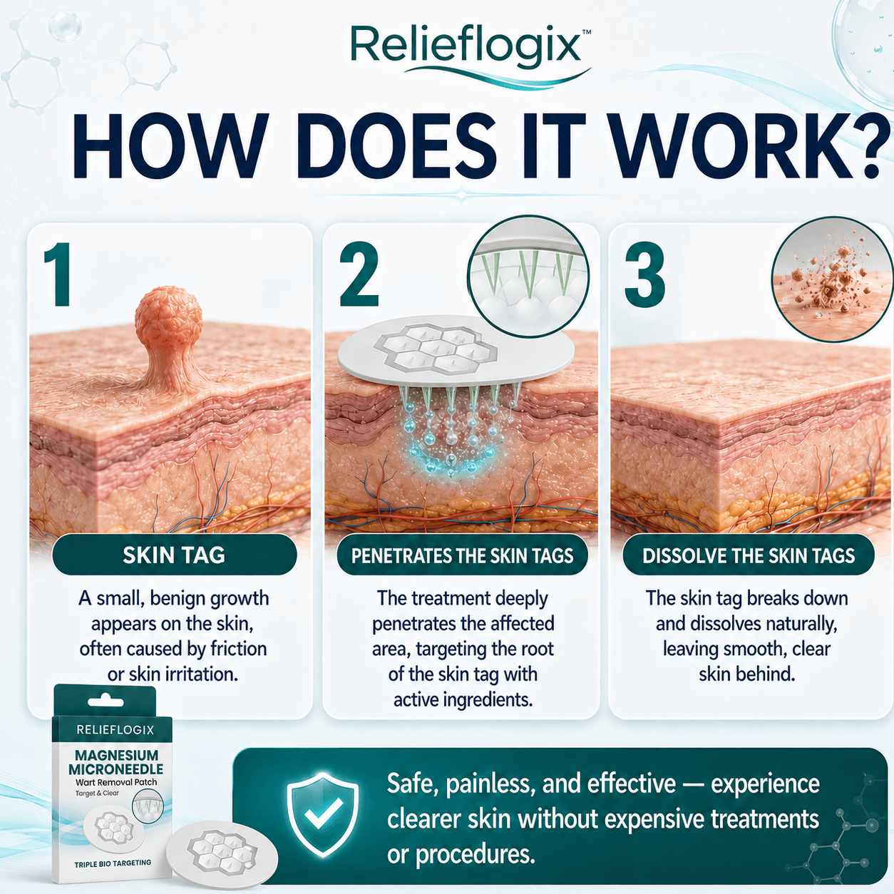 ReliefLogix Magnesium Microneedle Wart Removal Patch