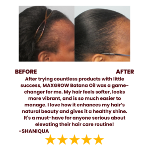 Maxgrow Batana Natural Hair Growth Oil